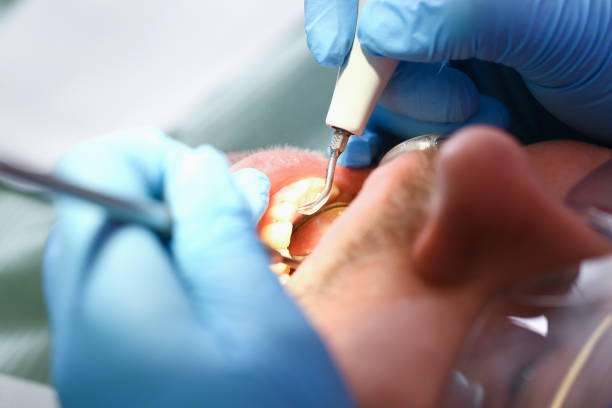 Best Emergency Denture Repair in Tremonton, UT