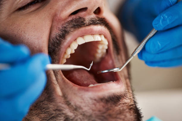 Best Urgent Care for Lost Fillings or Crowns in Tremonton, UT